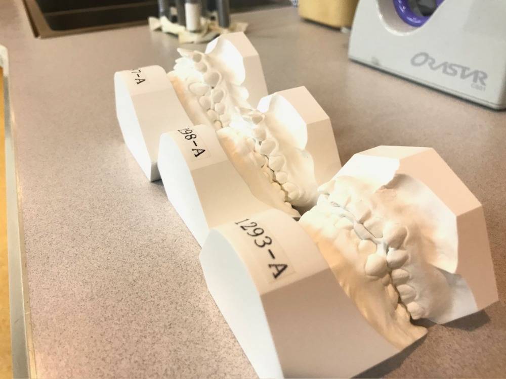 中村歯科の矯正治療について